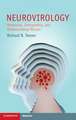 Neurovirology: Measuring, Interpreting, and Understanding Viruses