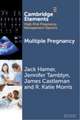 Multiple Pregnancy