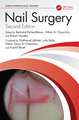 Nail Surgery