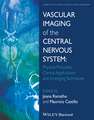 Vascular Imaging of the Central Nervous System – Physical Principles, Clinical Applications, and Emergency Techniques