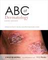 ABC of Dermatology