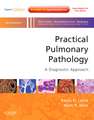 Practical Pulmonary Pathology: A Diagnostic Approach: A Volume in the Pattern Recognition Series