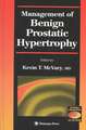 Management of Benign Prostatic Hypertrophy