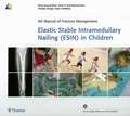 Elastic Stable Intramedullary Nailing (ESIN) in Children