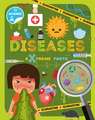 Diseases