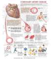 Coronary Artery Disease Chart