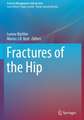 Fractures of the Hip