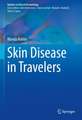 Skin Disease in Travelers