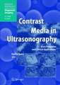 Contrast Media in Ultrasonography: Basic Principles and Clinical Applications