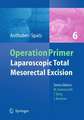 Laparoscopic Total Mesorectal Excision