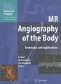 MR Angiography of the Body: Technique and Clinical Applications