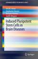 Induced Pluripotent Stem Cells in Brain Diseases: Understanding the Methods, Epigenetic Basis, and Applications for Regenerative Medicine.