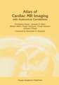 Atlas of Cardiac MR Imaging with Anatomical Correlations