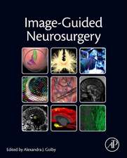 Image-Guided Neurosurgery