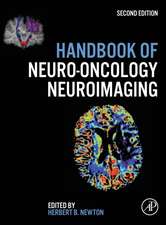 Handbook of Neuro-Oncology Neuroimaging