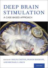 Deep Brain Stimulation: A Case-based Approach