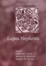 Lupus Nephritis