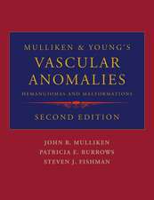 Mulliken and Young's Vascular Anomalies: Hemangiomas and Malformations