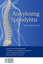 Ankylosing Spondylitis