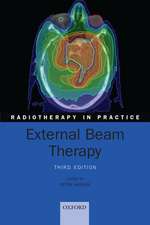 External Beam Therapy