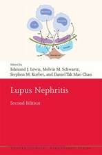 Lupus Nephritis