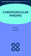 Cardiovascular Imaging