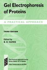 Gel Electrophoresis of Proteins: A Practical Approach