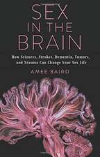 Sex in the Brain – How Seizures, Strokes, Dementia, Tumors, and Trauma Can Change Your Sex Life