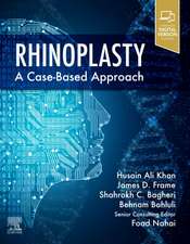 Rhinoplasty: a Case-based approach