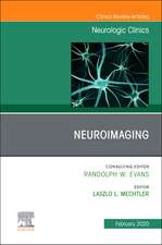 Neuroimaging, An Issue of Neurologic Clinics