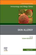 Skin Allergy, An Issue of Immunology and Allergy Clinics of North America