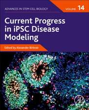 Current Progress in iPSC Disease Modeling