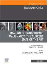 Imaging of Gynecologic Malignancy: The Current State of the Art, An Issue of Radiologic Clinics of North America