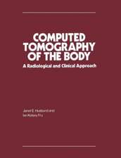 Computed Tomography of the Body: A Radiological and Clinical Approach