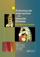 Endovascular Intervention for Vascular Disease: Principles and Practice