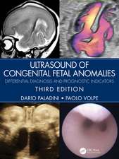 Ultrasound of Congenital Fetal Anomalies: Differential Diagnosis and Prognostic Indicators