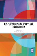 The Face Specificity of Lifelong Prosopagnosia