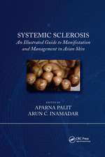 Systemic Sclerosis: An Illustrated Guide to Manifestation and Management in Asian Skin