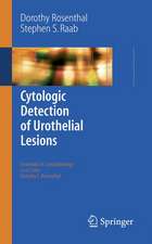 Cytologic Detection of Urothelial Lesions