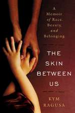 The Skin Between Us – A Memoir of Race, Beauty and Belonging