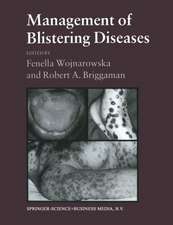 Management of Blistering Diseases