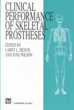 Clinical Perfomance of Skeletal Prostheses