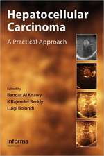 Hepatocellular Carcinoma: A Practical Approach