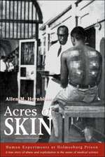 Acres of Skin: Human Experiments at Holmesburg Prison