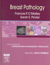 Breast Pathology: A Volume in Foundations in Diagnostic Pathology Series