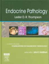 Endocrine Pathology: A Volume in Foundations in Diagnostic Pathology Series