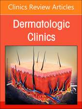 Hidradenitis Suppurativa, An Issue of Dermatologic Clinics