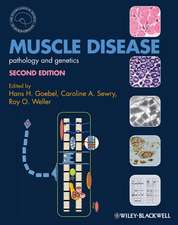 Muscle Disease – Pathology and Genetics