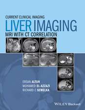 Liver Imaging – MRI with CT Correlation