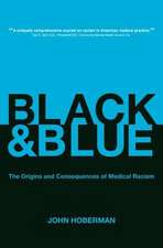 Black and Blue – The Origins and Consequences of Medical Racism